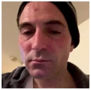 John 1 Heroin Cure - Day Before Arrival