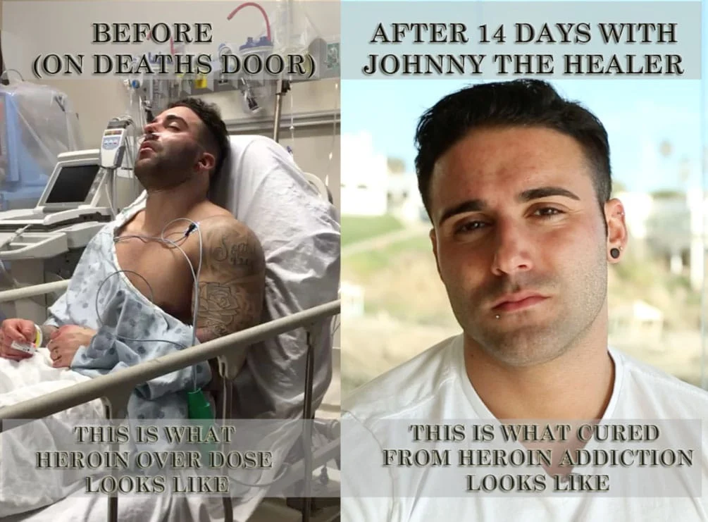 Heroin Addiction Rehab