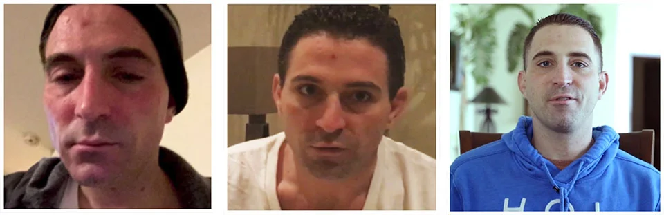 John's Heroin Reabilitation with Best Ibogaine Treatment Mexico
