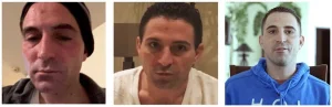 John's Drug Reabilitation and Recovery with the Pouyan Method Treatment