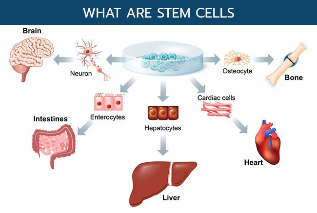What stem cells are and how they are used in therapy