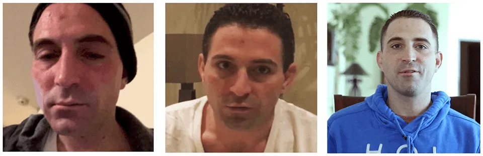 Johns Drug Reabilitation with the Pouyan Method Treatment.png 2